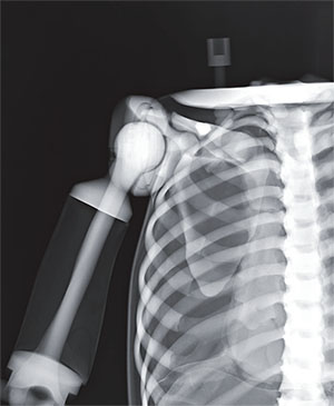 PBU X-Ray Training Manikin - Patient Simulator for X-Ray Positioning - X-Ray 2