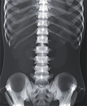 PBU X-Ray Training Manikin - Patient Simulator for X-Ray Positioning - X-Ray 3