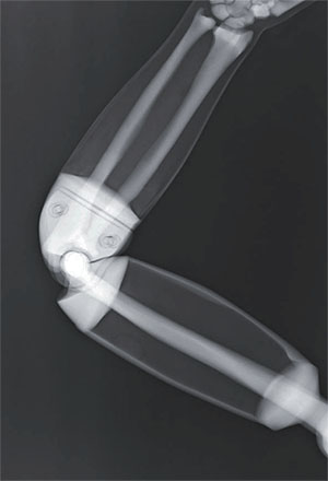 PBU X-Ray Training Manikin - Patient Simulator for X-Ray Positioning - X-Ray 4