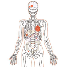 CT Whole Body Phantom with Pathologies - PH-2E - Kyoto Kagaku - Phantom 2