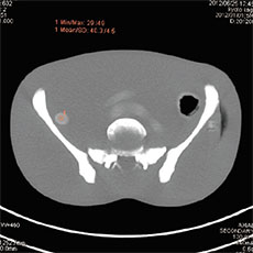 CT Whole Body Phantom with Pathologies - PH-2E - Kyoto Kagaku - CT 1