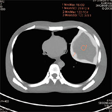 CT Whole Body Phantom with Pathologies - PH-2E - Kyoto Kagaku - CT 2