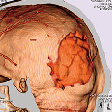 CT Whole Body Phantom with Pathologies - PH-2E - Kyoto Kagaku - CT 3