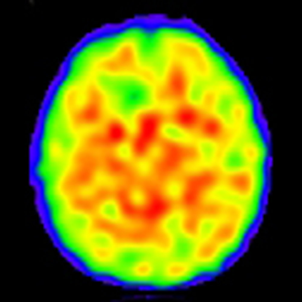 PH-34 nuclear medicine head image