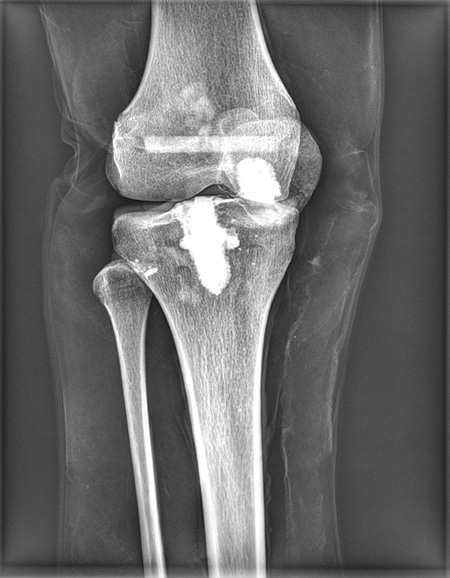 Erler Zimmer Natural Bone Full Body X-Ray Phantom - 7200 - xray 4