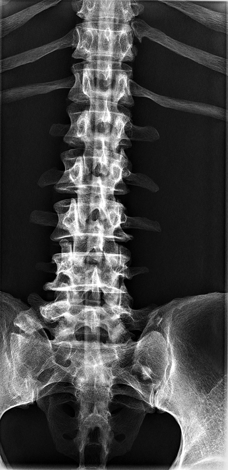 Erler Zimmer Natural Bone Full Body X-Ray Phantom - 7200 - xray 7