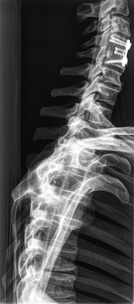 Erler Zimmer Natural Bone Full Body X-Ray Phantom - 7200 - xray 9