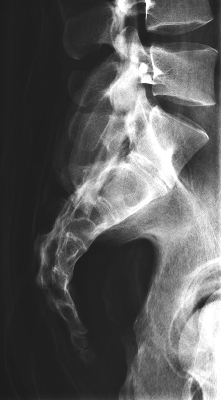 Erler Zimmer Natural Bone Full Body X-Ray Phantom - 7200 - xray 1
