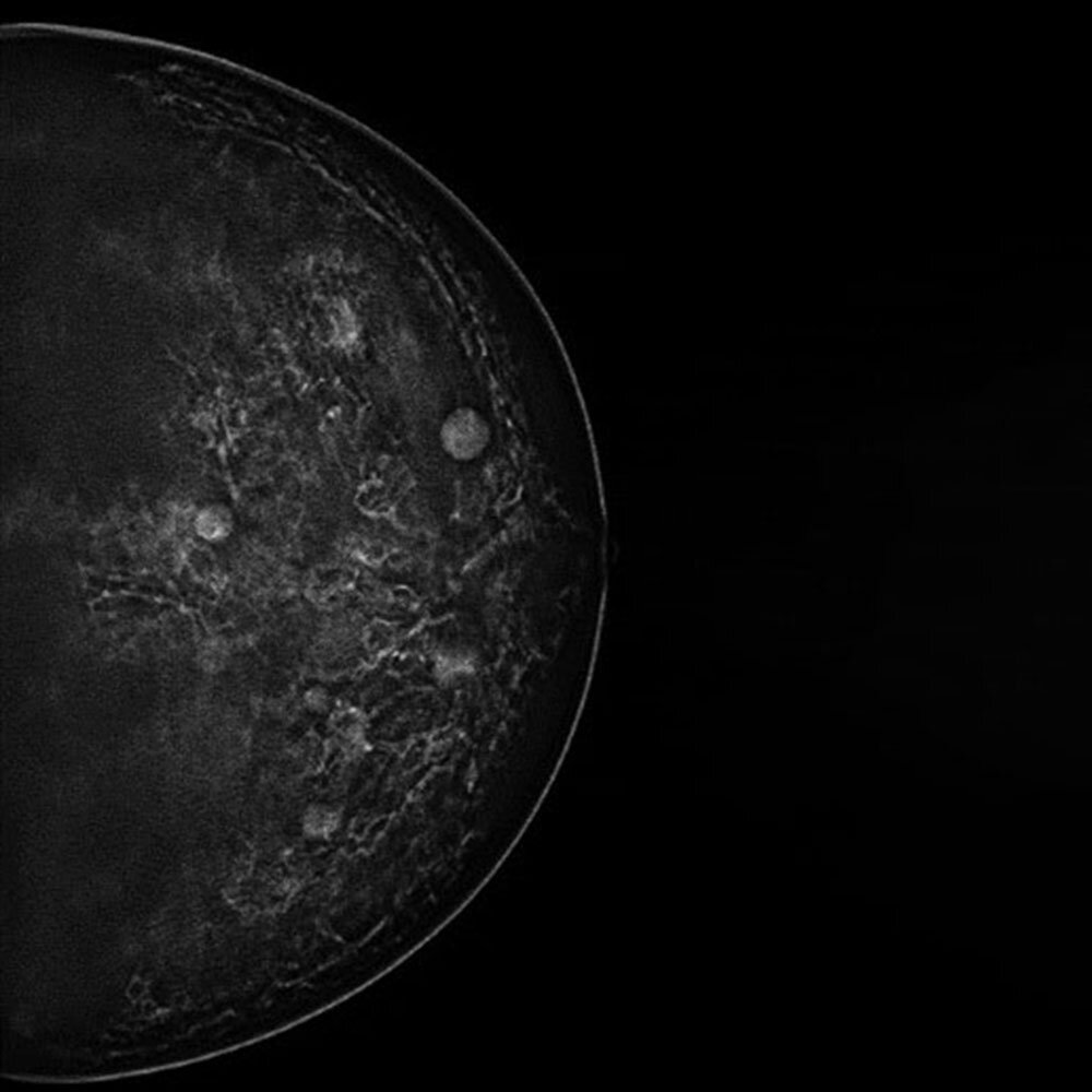 PH-83 mammography image with a different target position