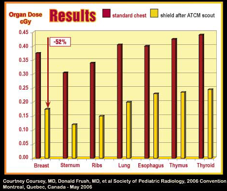 AttenuRad CT Female Pediatric Chart