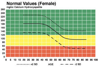 Bone Density Test Chart