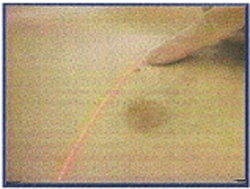 FastFind Grid EG6500 Remove the grid and perform your biopsy
