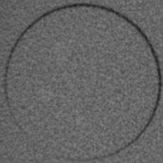 SedentexCT IQ Dental CBCT - CT Scans Contrast Resolution (HA 100)