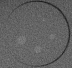 SedentexCT IQ Dental CBCT - CT Scans Contrast Resolution (HA 200)