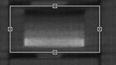 SedentexCT IQ Dental CBCT - CT Scans Contrast-to-noise coronal view