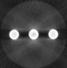 SedentexCT IQ Dental CBCT - CT Scans Artefacts