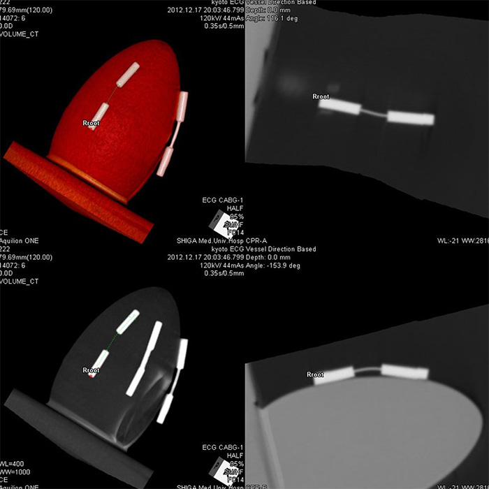 Dynamic Cardiac CT Phantom MD-CT - PH-6B - Kyoto Kagaku - 4