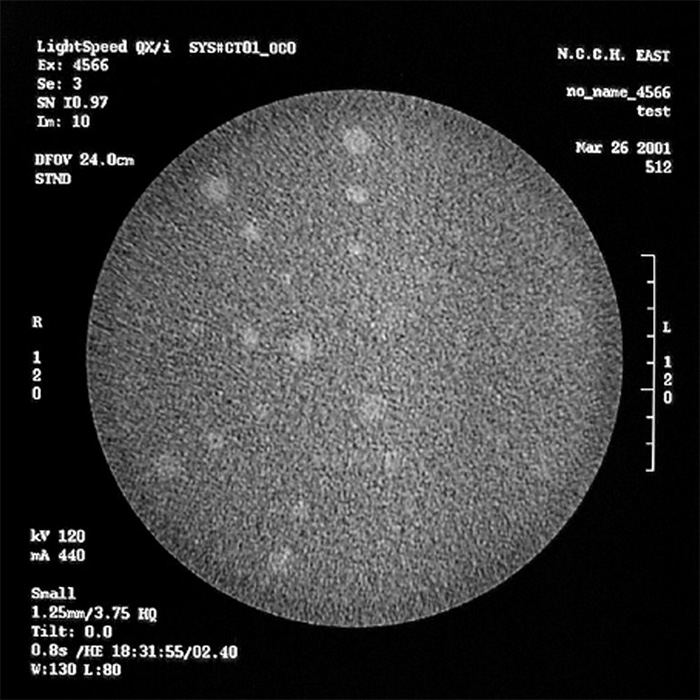 Multi-Slice CT Phantom MHT - PH-9 - Kyoto Kagaku - CT Image 1