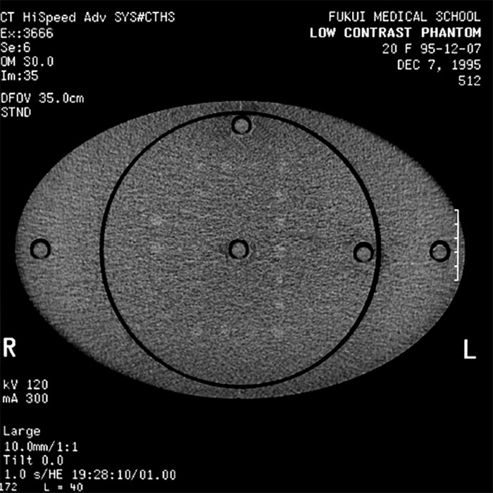 Multi-Slice CT Phantom MHT - PH-9 - Kyoto Kagaku - CT Image 3