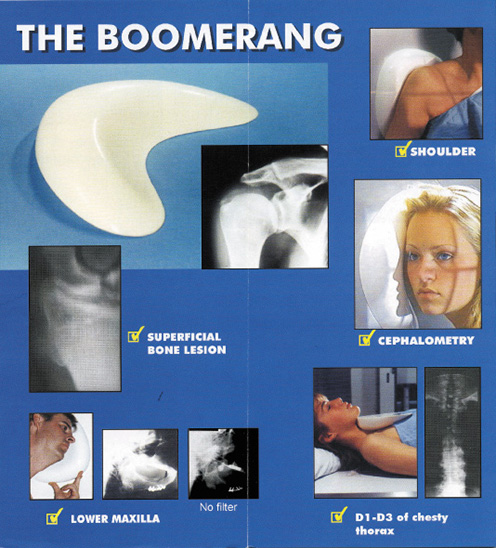 The Boomerang - OCTOSTOP - X-ray Compensating Filter