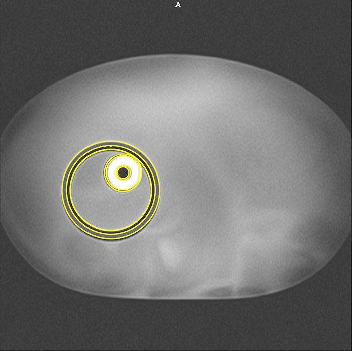 CIRS 008M - Target MRI Distortioned vs CAD Model