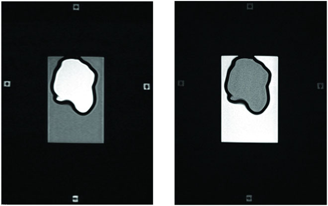 Axial T1 and T2 images of 50 cc Organic Target Insert aligned to external MR/CT fiducials