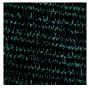 MRI Furniture Fabric Choices Forest Green