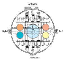 Partial cross section view from inferior side