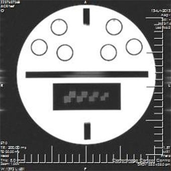 Pro-MRI - Pro-Project - 09-101 - MRI 2