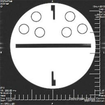 Pro-MRI - Pro-Project - 09-101 - MRI 3