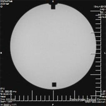Pro-MRI - Pro-Project - 09-101 - MRI 6