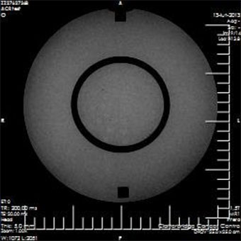 Pro-MRI - Pro-Project - 09-101 - MRI 7