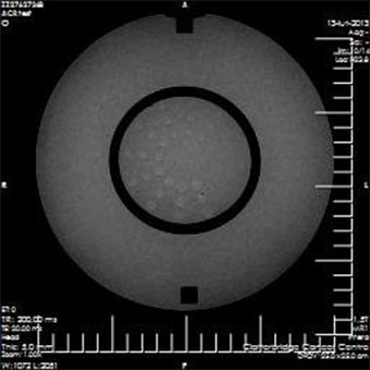 Pro-MRI - Pro-Project - 09-101 - MRI 8