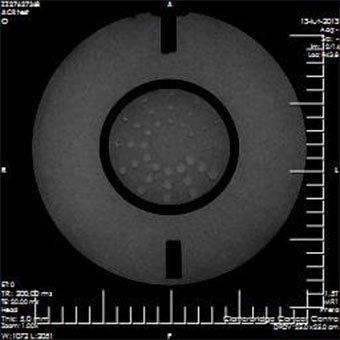 Pro-MRI - Pro-Project - 09-101 - MRI 10