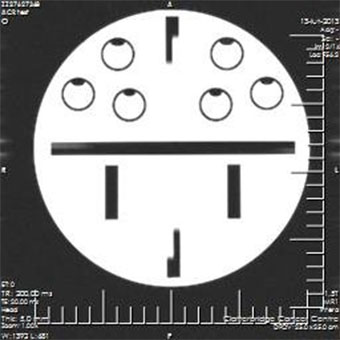 Pro-MRI - Pro-Project - 09-101 - MRI 1