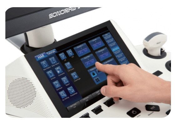 Sonorad V40 Color Doppler Ultrasound System