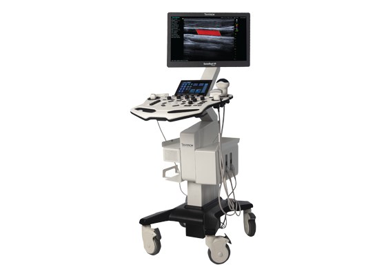 SonoRad V9 Ultrasound System