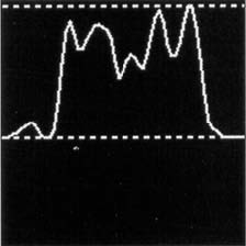 SPECT chart