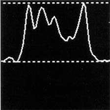 SPECT chart