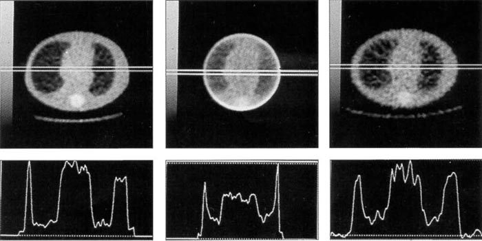 Elliptical Lung-Spine Phantom™ CT Scan Images