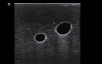Internal jugular trainer ultrasound example 1