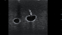 Internal jugular trainer ultrasound example 3