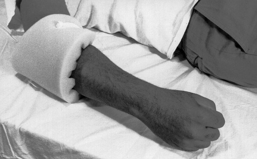 Ulna Nerve Protector