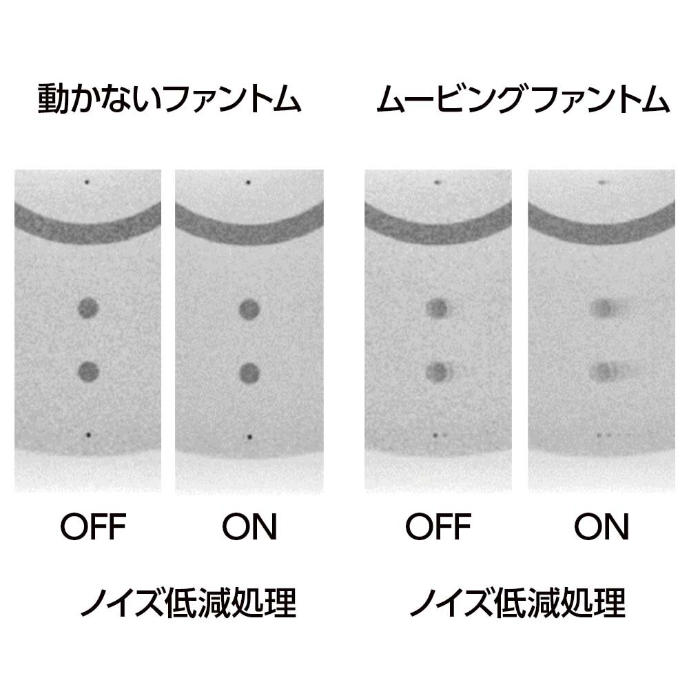 PH-81 static and moving image comparison with noise reduction off and on