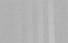 QUART DSA - Digital Subtraction Angiography QA Test Phantom