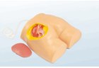 Buttock Injection Model - PC-NUE007.03