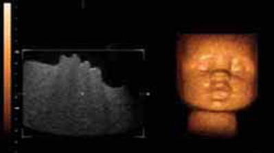 Baby's Head Teaching Ultrasound Phantom ATS 3DBH 3