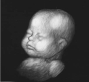 3D Full Term Baby Ultrasound Phantom ATS 3DFB Head