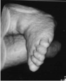 3D Full Term Baby Ultrasound Phantom ATS 3DFB Feet