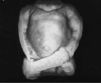 3D Full Term Baby Ultrasound Phantom ATS 3DFB Torso